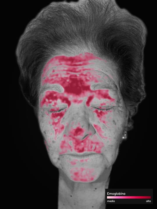 Mappa Emoglobina sul volto demo