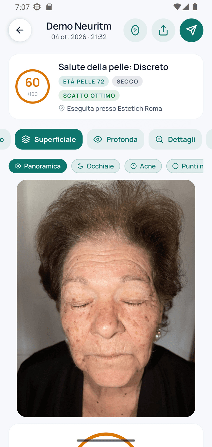 Analisi superficiale con punteggio 60 e età pelle 72