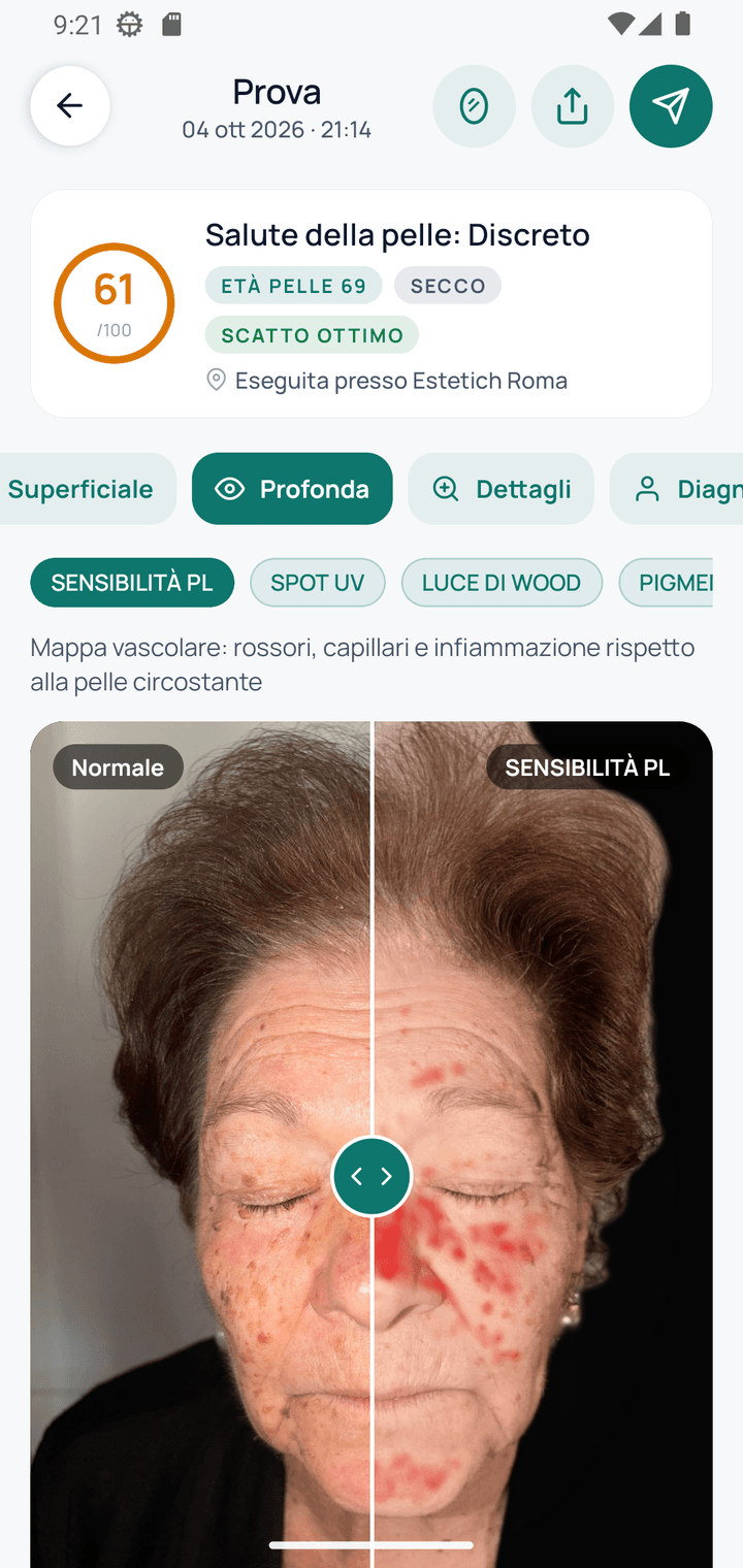 Analisi profonda con slider prima/dopo della sensibilità